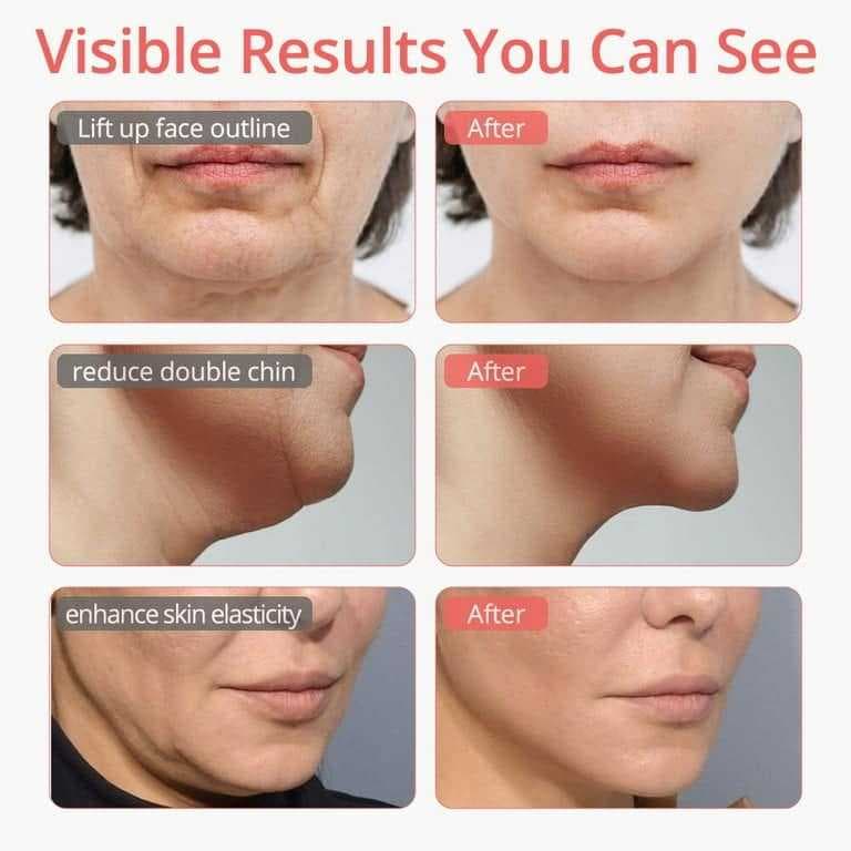 جهاز تنحيف الوجه الذكي تشكيل الفك للنساء والرجال