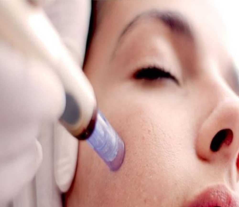 ديرما بن derma pen