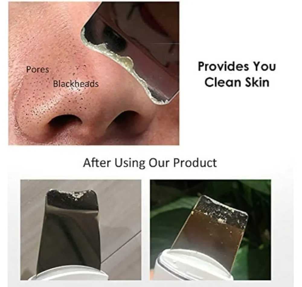 جهاز تنظيف وتقشير البشرة